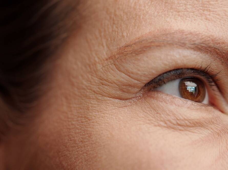 Botox for Forehead Wrinkles Your Guide to Smoother Skin