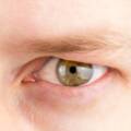 What’s Causing Droopy Eyes and How To Treat Them